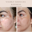 Luxury Beauty Serum (Collective)