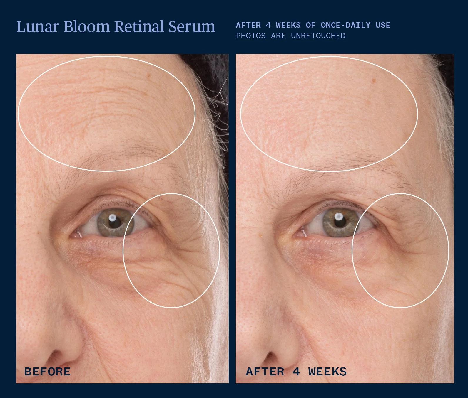 Lunar Bloom Retinal Serum - Living with Ivey