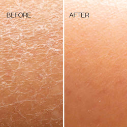 Esker | Body Plane Exfoliator Tool