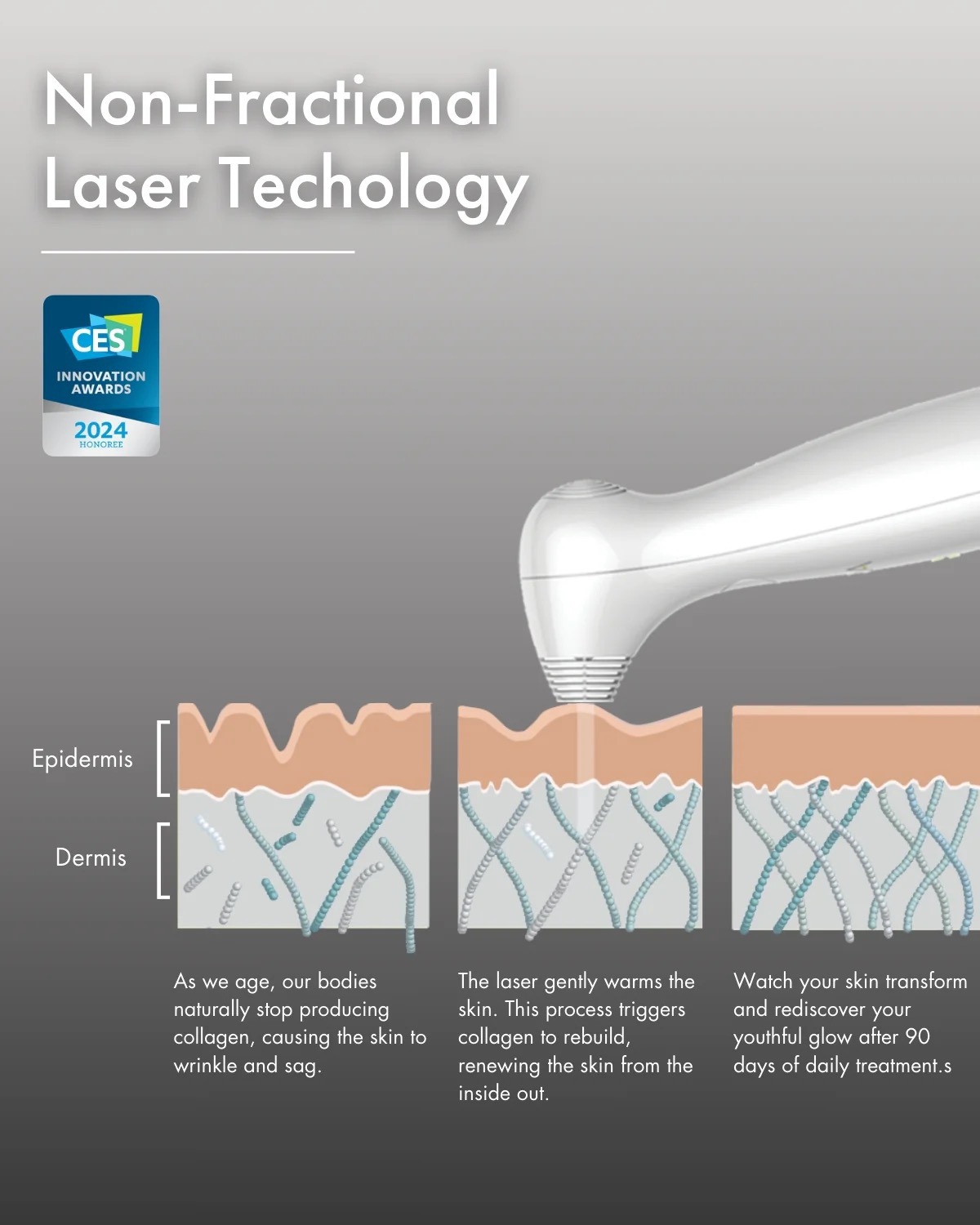 Nira Pro Laser