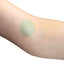Esker | Lymphatic Drainage Dots