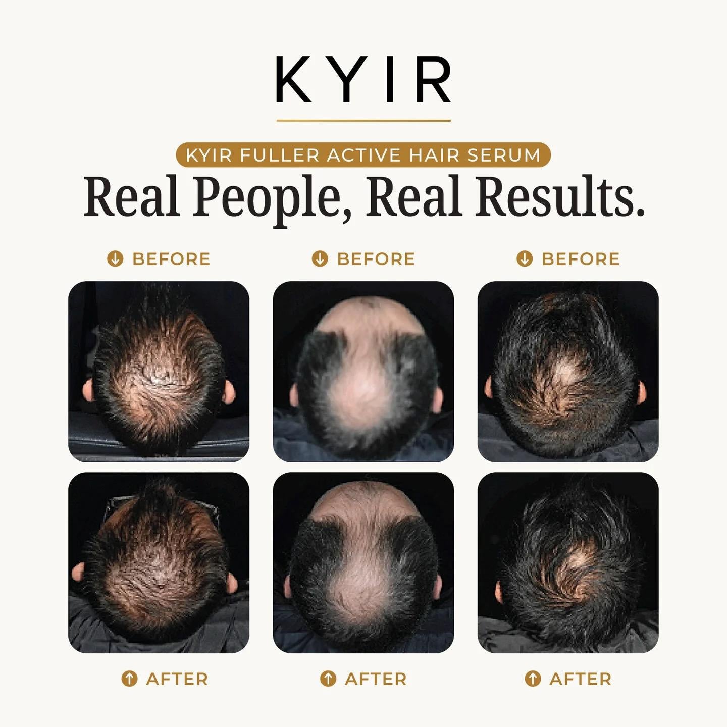 KYIR Fuller Active Hair Serum - Thumbnail 5