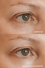 Eye Defy - Goldfaden MD - Living with Ivey