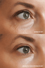 Eye Defy - Goldfaden MD - Living with Ivey