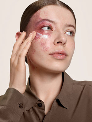 ZnO+ Mineral Care Calm and Revitalize - Sunsolve MD - Living with Ivey